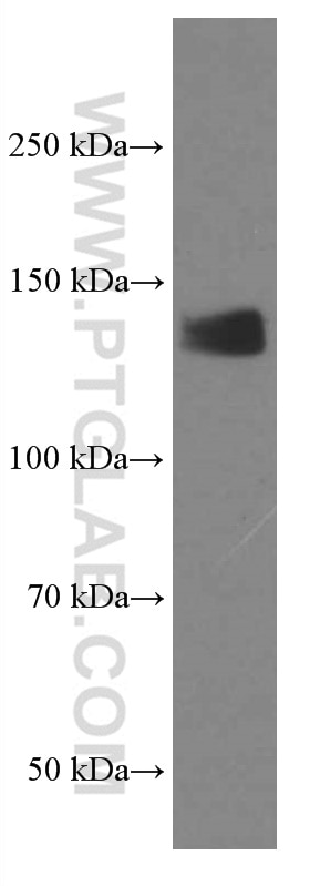 Western Blot (WB) analysis of T-47D cells using LATS1 Monoclonal antibody (66569-1-Ig)