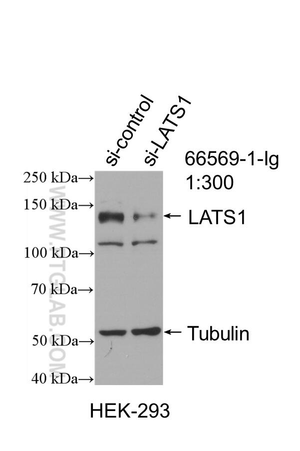 Western Blot (WB) analysis of HepG2 cells using LATS1 Monoclonal antibody (66569-1-Ig)