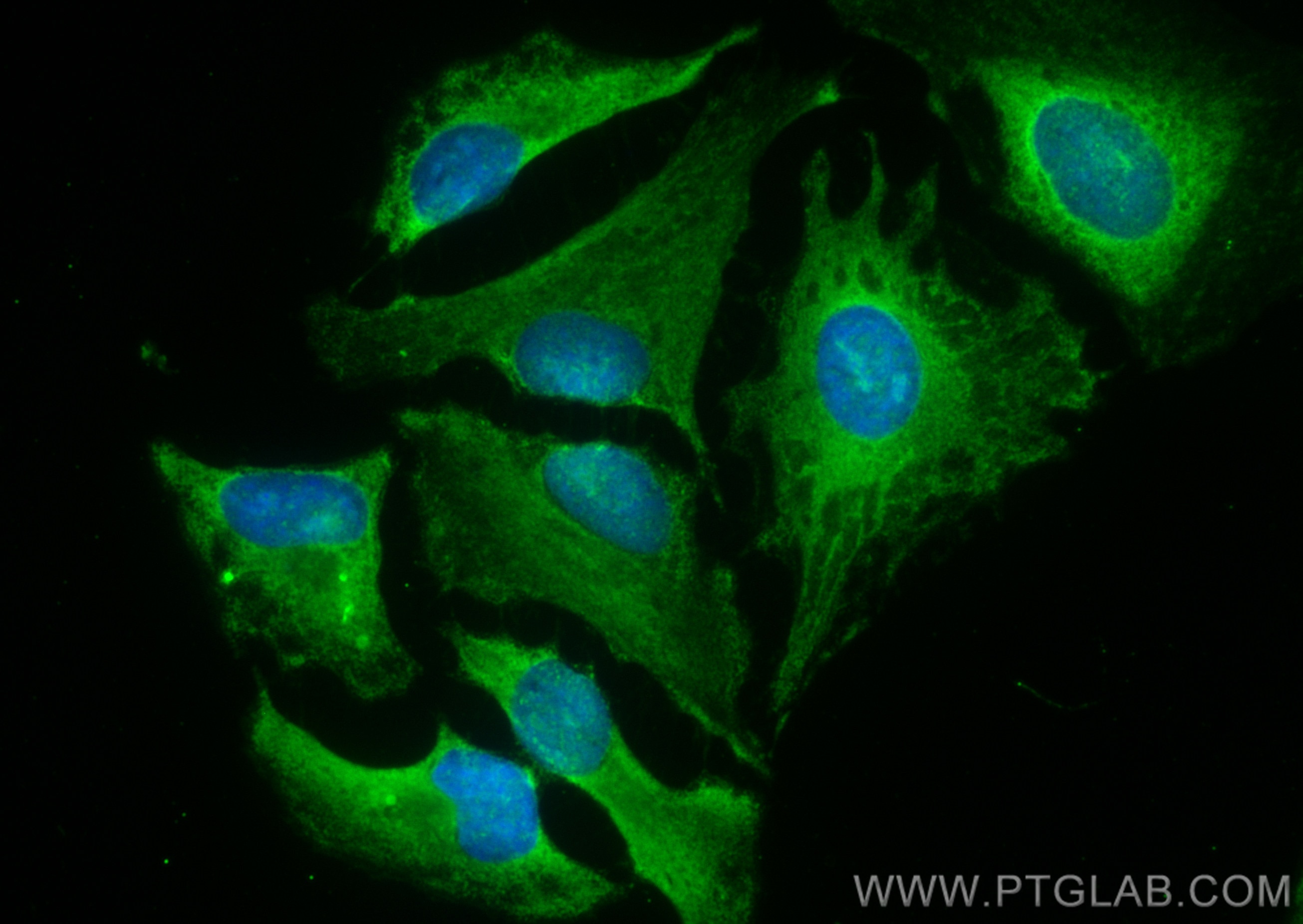 Immunofluorescence (IF) / fluorescent staining of HeLa cells using CoraLite® Plus 488-conjugated LATS1 Polyclonal ant (CL488-17049)