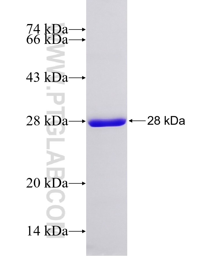 LATS1 fusion protein Ag33203 SDS-PAGE LATS1 fusion protein Ag33203 SDS-PAGE