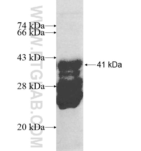 LATS1 fusion protein Ag10709 SDS-PAGE