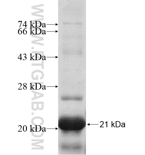 LATS1 fusion protein Ag11140 SDS-PAGE