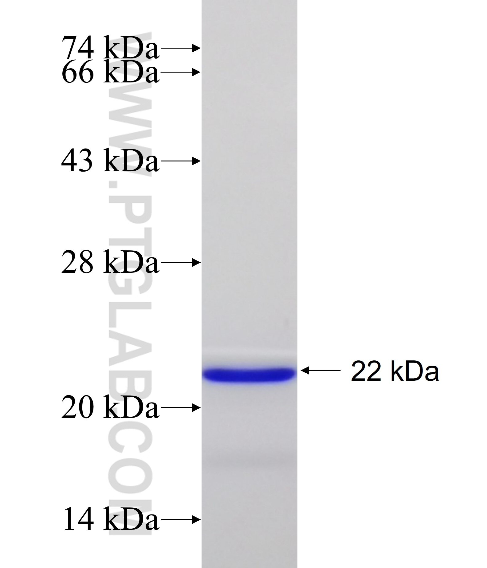 LATS1 fusion protein Ag11140 SDS-PAGE