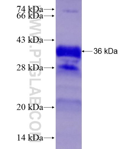 LATS2 fusion protein Ag28270 SDS-PAGE
