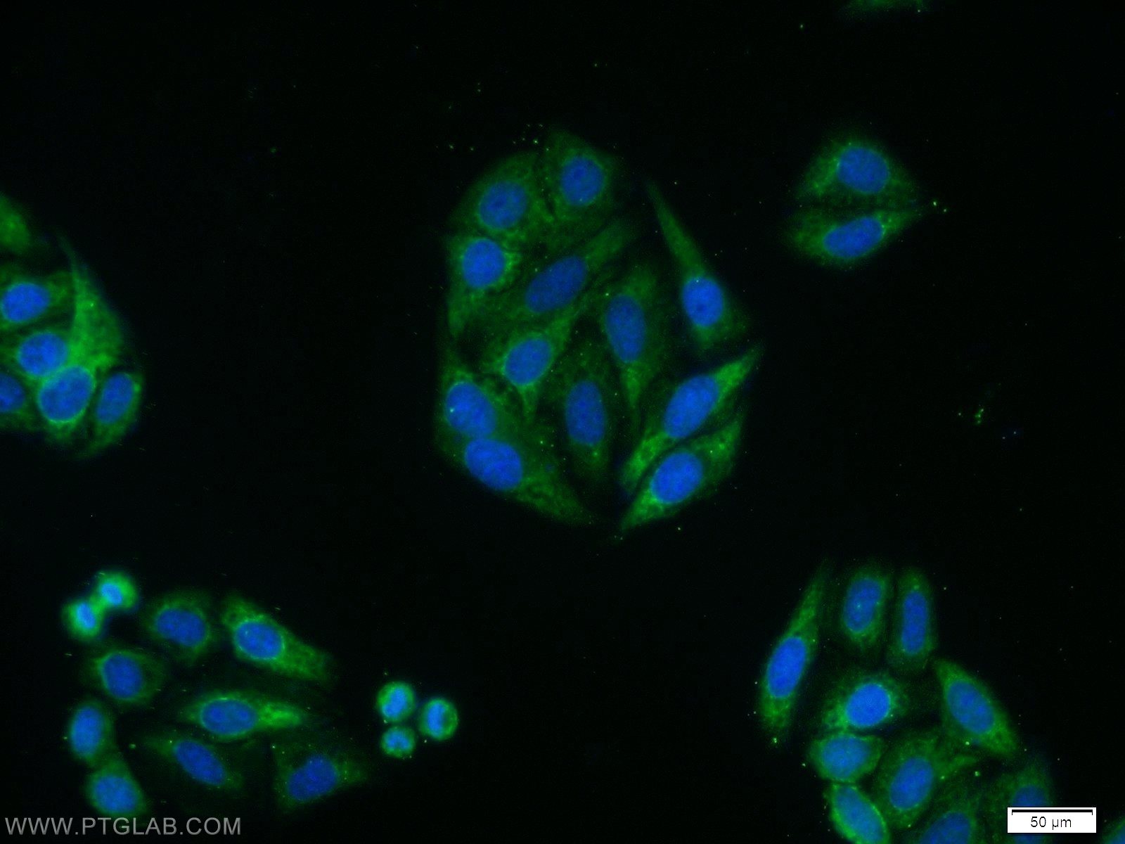 Immunofluorescence (IF) / fluorescent staining of HepG2 cells using LATS2-Specific Polyclonal antibody (20276-1-AP)