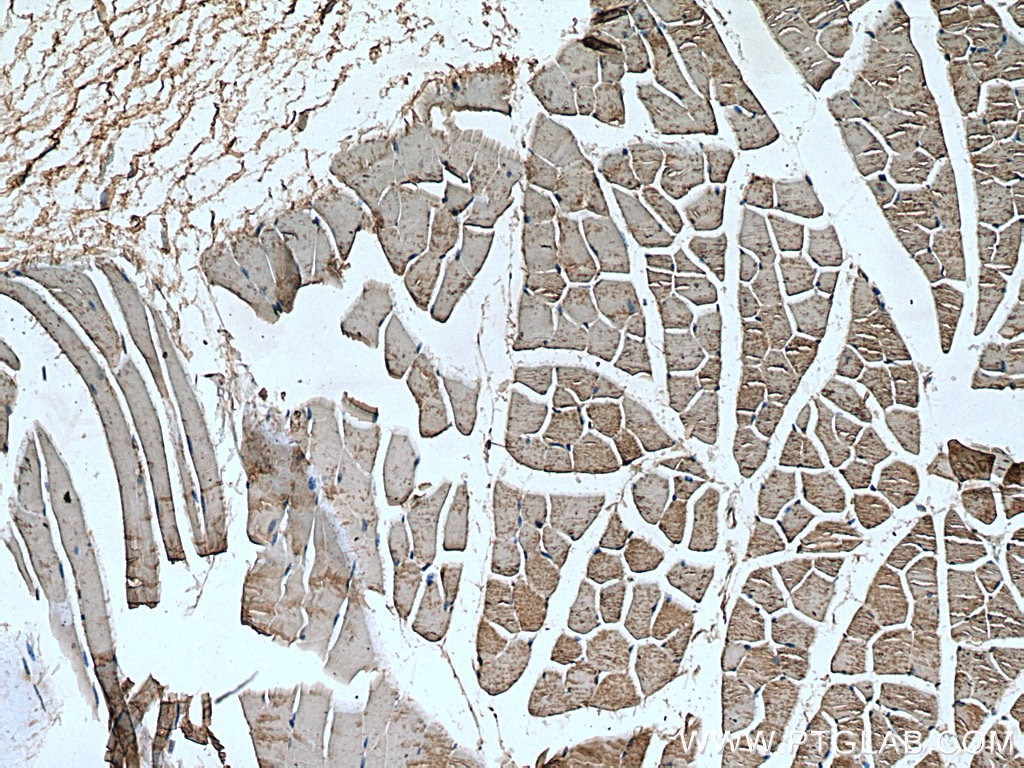 Immunohistochemistry (IHC) staining of mouse skeletal muscle tissue using LATS2-Specific Polyclonal antibody (20276-1-AP)