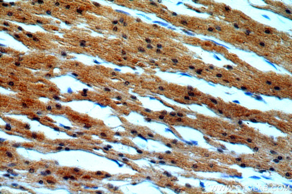 Immunohistochemistry (IHC) staining of human colon tissue using LATS2-Specific Polyclonal antibody (20276-1-AP)