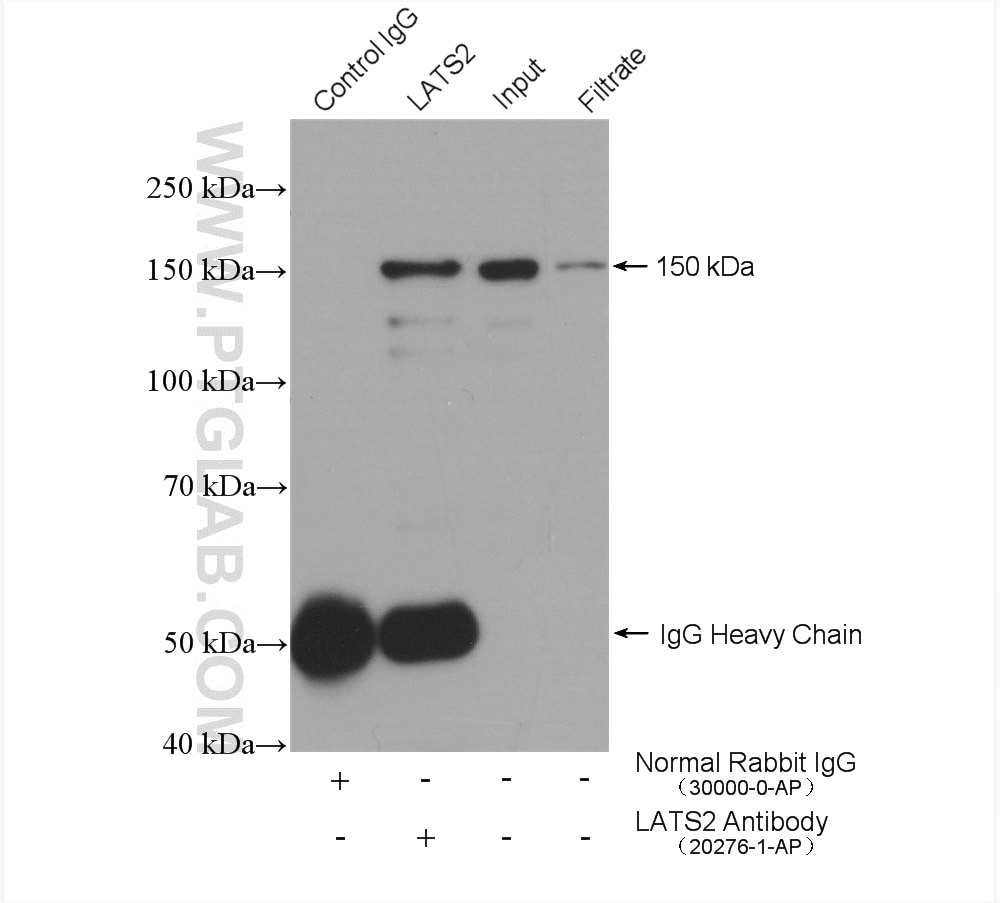 Immunoprecipitation (IP) experiment of HEK-293 cells using LATS2-Specific Polyclonal antibody (20276-1-AP)