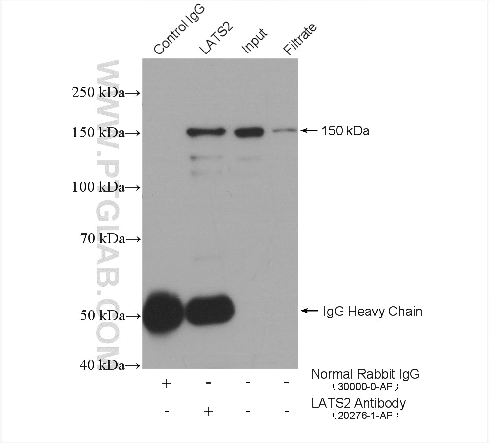 IP experiment of HEK-293 using 20276-1-AP