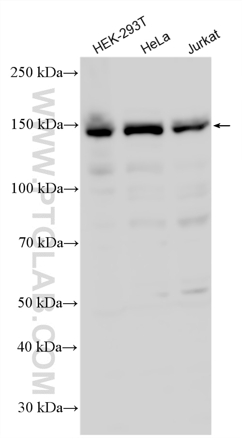 Various lysates were subjected to SDS PAGE followed by western blot with 20276-1-AP (LATS2-Specific antibody) at dilution of 1:1000 incubated at room temperature for 1.5 hours. Western Blot (WB) analysis of various lysates using LATS2-Specific Polyclonal antibody (20276-1-AP)