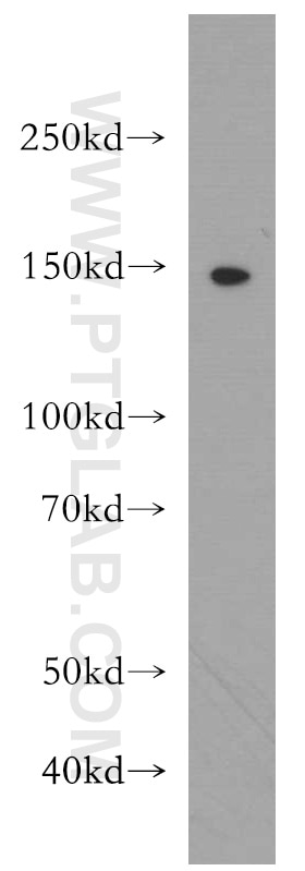 Western Blot (WB) analysis of mouse brain tissue using LATS2-Specific Polyclonal antibody (20276-1-AP)