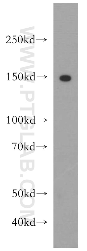 Western Blot (WB) analysis of SGC-7901 cells using LATS2-Specific Polyclonal antibody (20276-1-AP)