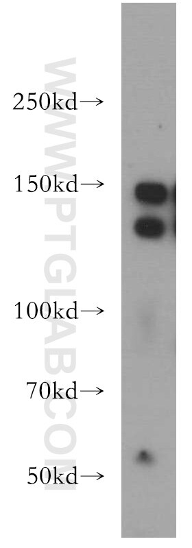 Western Blot (WB) analysis of human heart tissue using LATS2-Specific Polyclonal antibody (20276-1-AP)