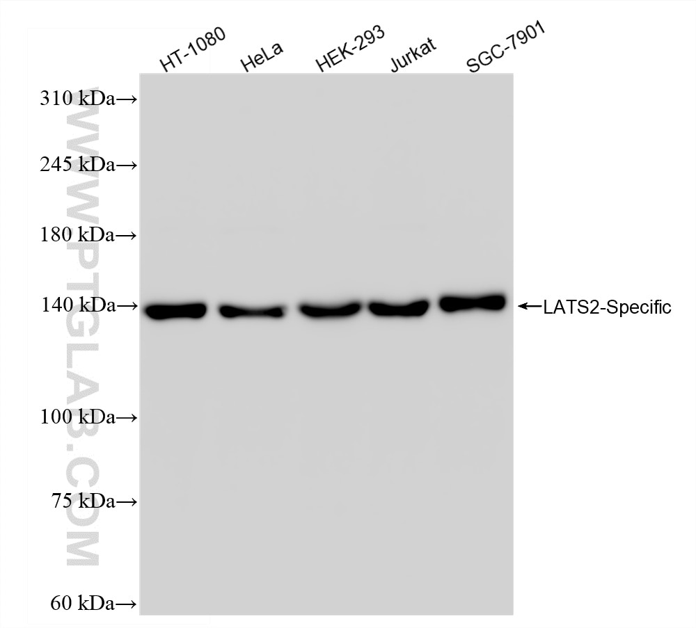 WB analysis using 88282-1-RR (same clone as 88282-1-PBS) Western Blot (WB) analysis of various lysates using LATS2-Specific Recombinant monoclonal antibody (88282-1-RR)