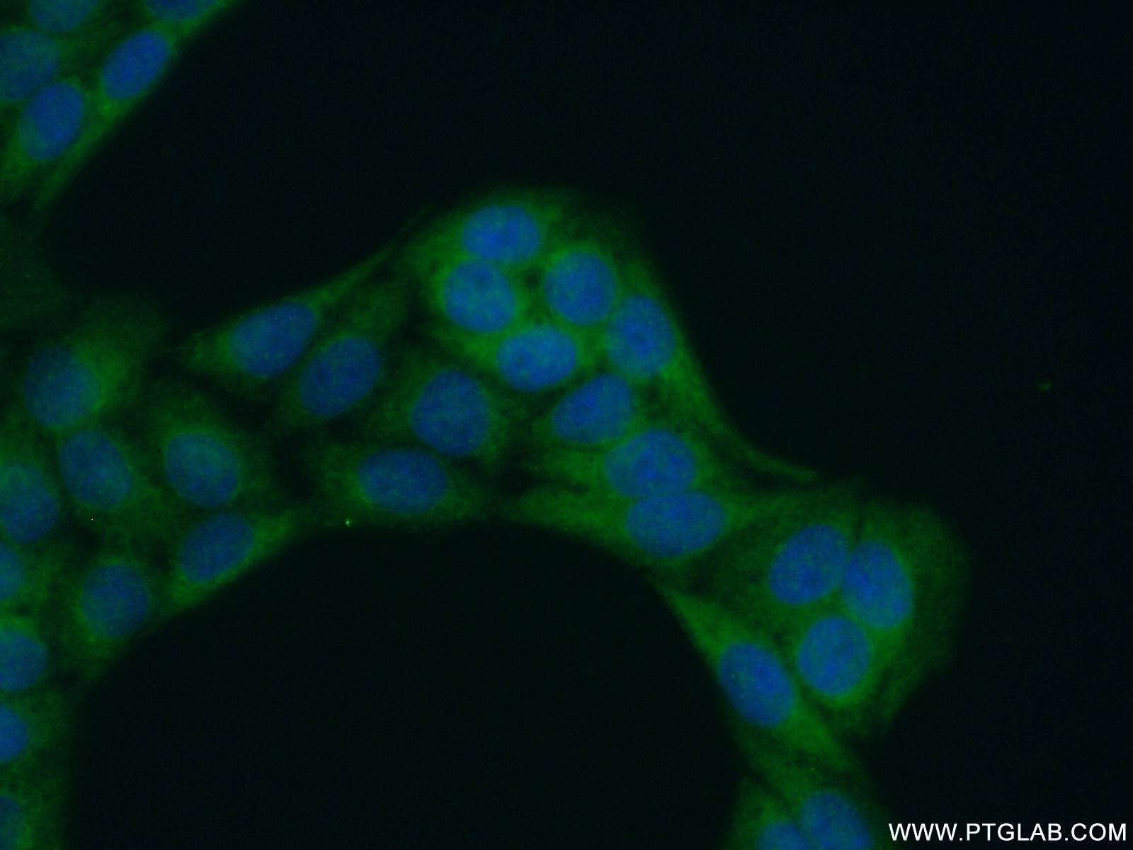 Immunofluorescence (IF) / fluorescent staining of HeLa cells using LAX1 Polyclonal antibody (21557-1-AP)
