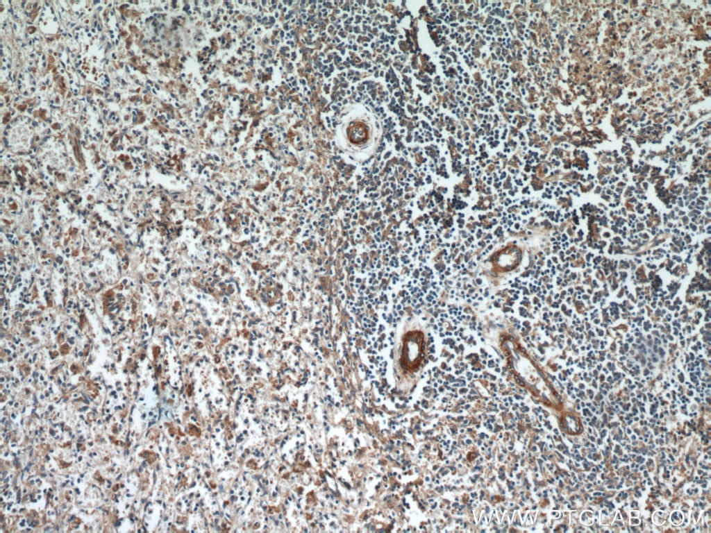 Immunohistochemistry (IHC) staining of human spleen tissue using LAX1 Polyclonal antibody (21557-1-AP)