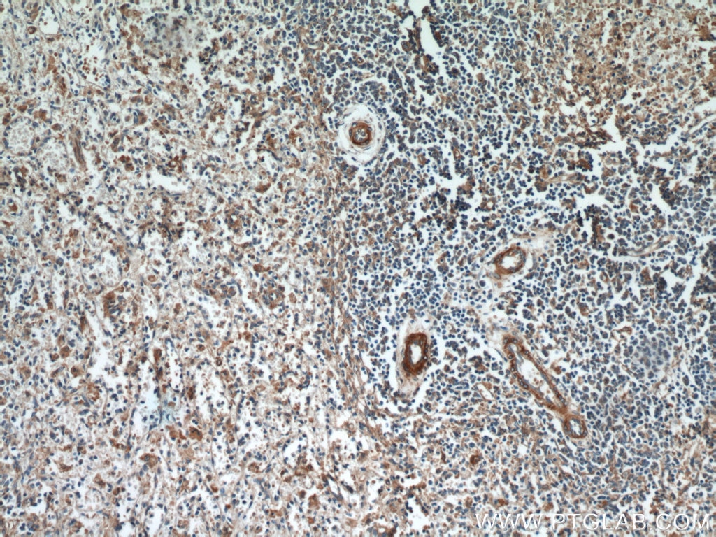 IHC staining of human spleen using 21557-1-AP