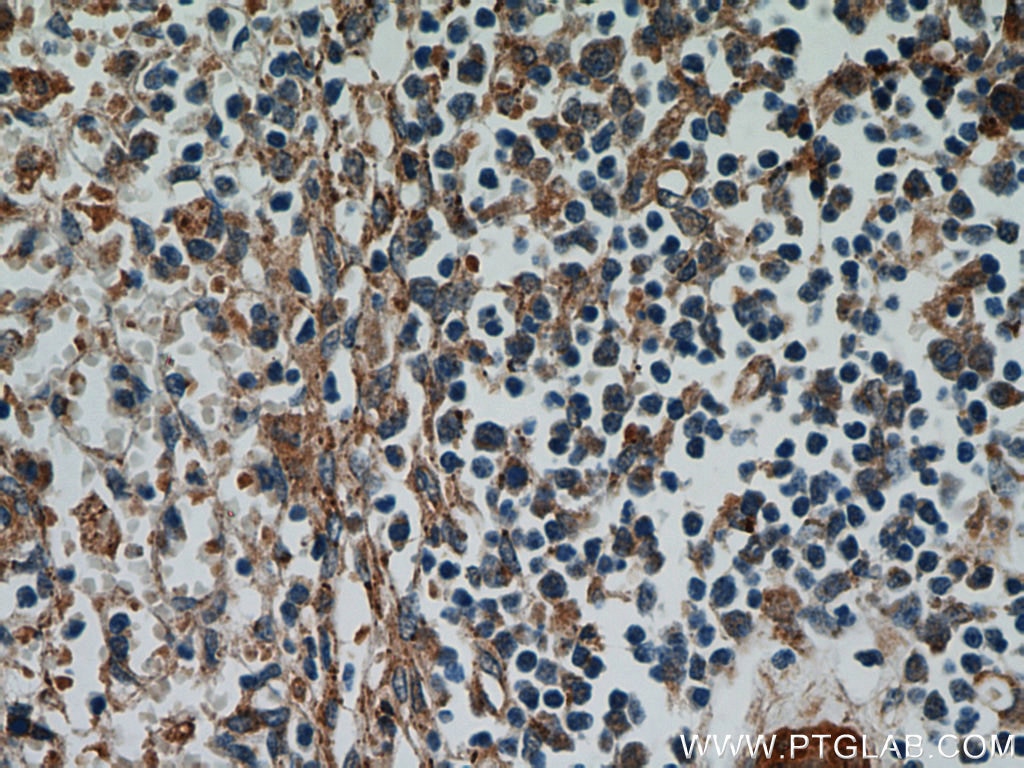 Immunohistochemistry (IHC) staining of human spleen tissue using LAX1 Polyclonal antibody (21557-1-AP)