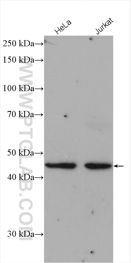 Western Blot (WB) analysis of various lysates using LAX1 Polyclonal antibody (21557-1-AP)