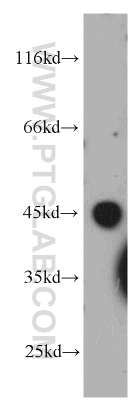 Western Blot (WB) analysis of HeLa cells using LAX1 Polyclonal antibody (21557-1-AP)