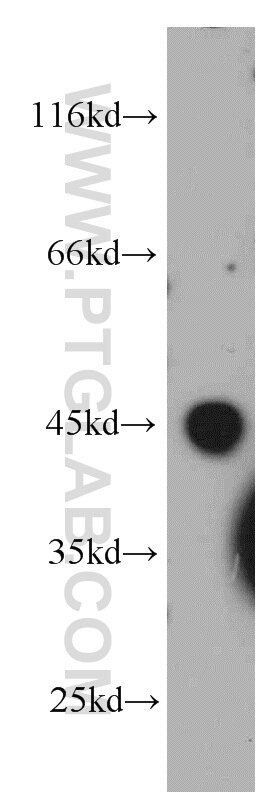 WB analysis of HeLa using 21557-1-AP