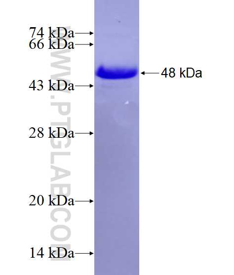 LAX1 fusion protein Ag16541 SDS-PAGE