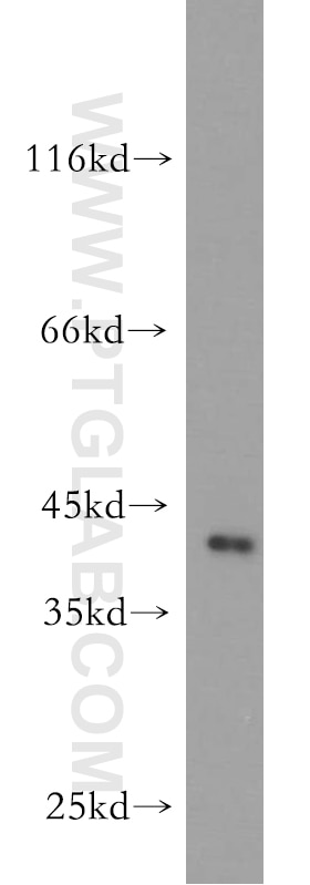 Western Blot (WB) analysis of mouse brain tissue using LAYN Polyclonal antibody (20535-1-AP)