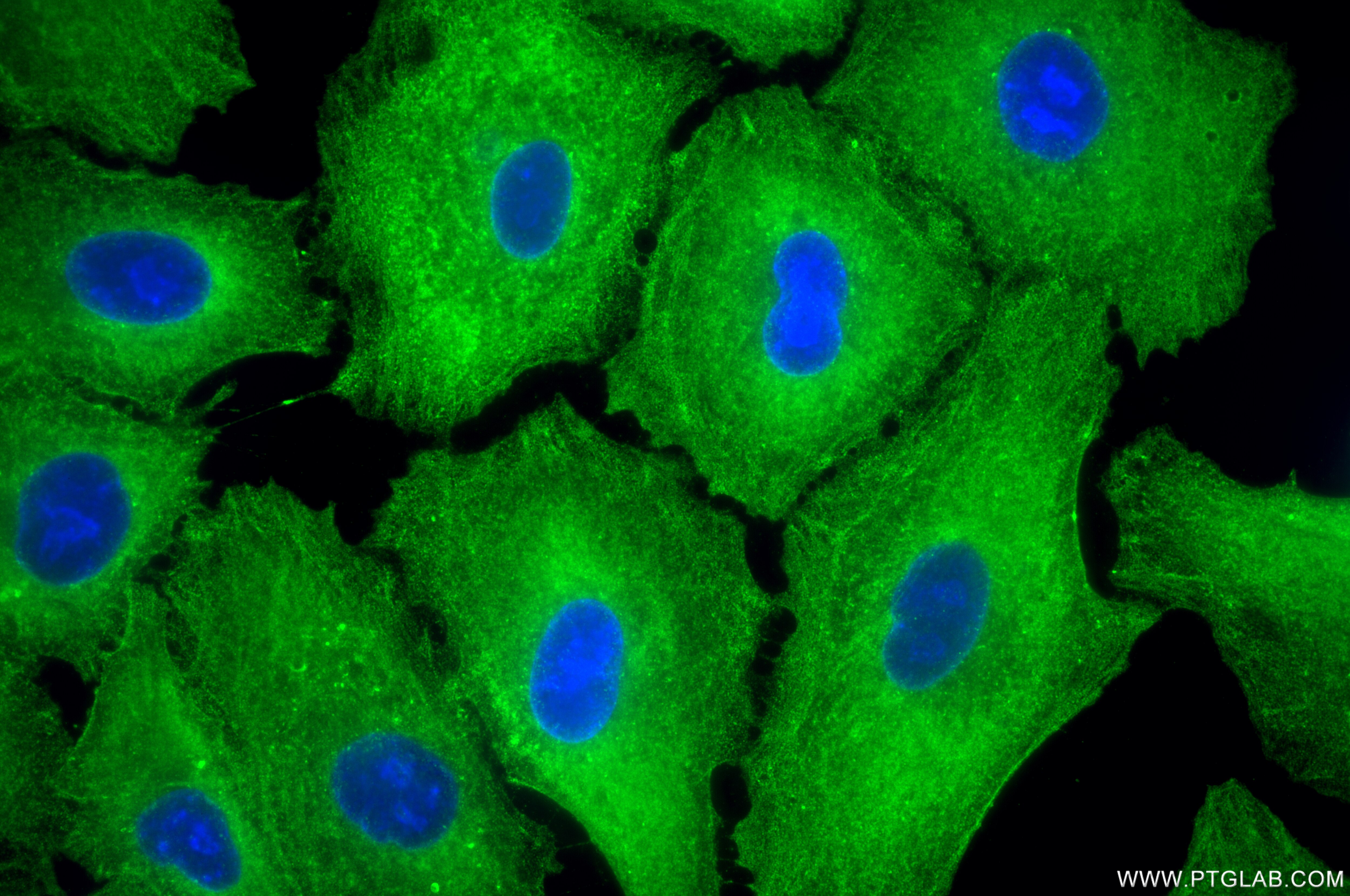 Immunofluorescence (IF) / fluorescent staining of A549 cells using LAYN Recombinant antibody (85900-1-RR)