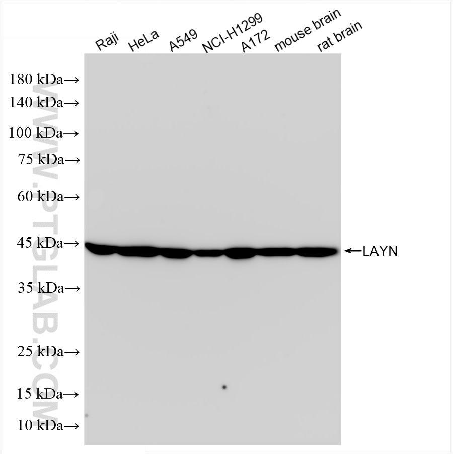 Western Blot (WB) analysis of various lysates using LAYN Recombinant antibody (85900-1-RR)