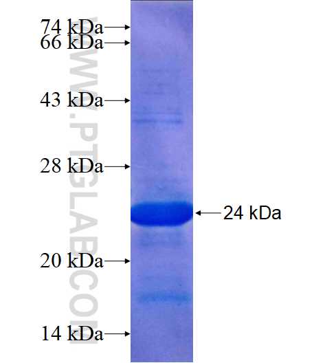 LAYN fusion protein Ag14508 SDS-PAGE