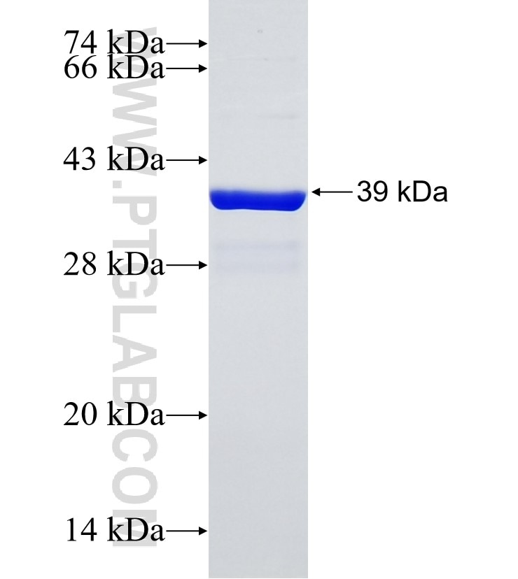 LBH fusion protein Ag34906 SDS-PAGE