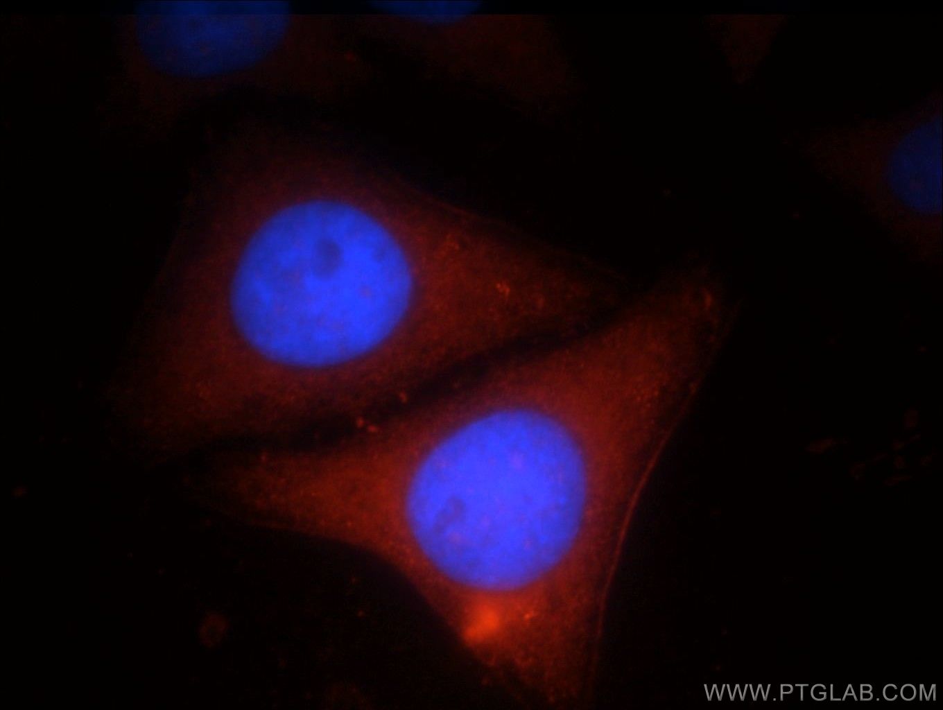 Immunofluorescence (IF) / fluorescent staining of HepG2 cells using LBP Polyclonal antibody (11836-1-AP)