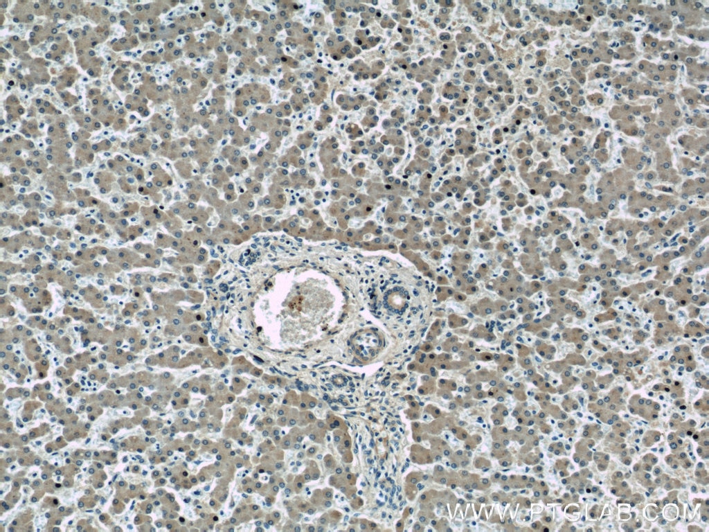 IHC staining of human liver using 11836-1-AP