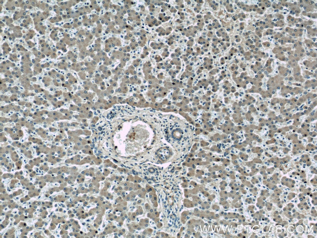 Immunohistochemistry (IHC) staining of human liver tissue using LBP Polyclonal antibody (11836-1-AP)