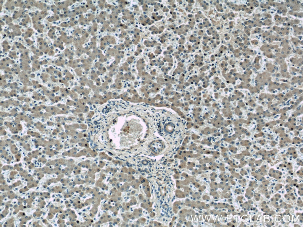 Immunohistochemistry (IHC) staining of human liver tissue using LBP Polyclonal antibody (11836-1-AP)