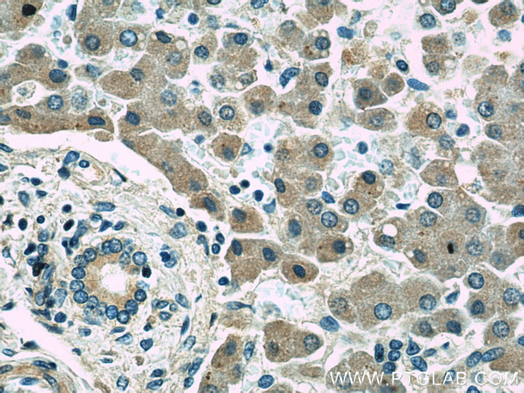 Immunohistochemistry (IHC) staining of human liver tissue using LBP Polyclonal antibody (11836-1-AP)