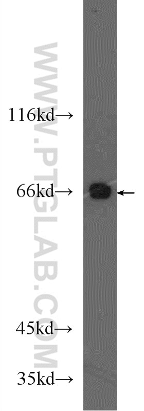 Western Blot (WB) analysis of rat liver tissue using LBP Polyclonal antibody (11836-1-AP)