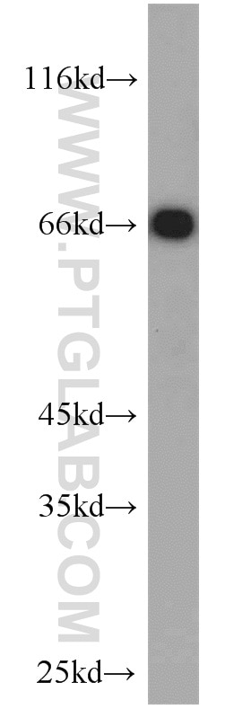 Western Blot (WB) analysis of mouse liver tissue using LBP Polyclonal antibody (11836-1-AP)