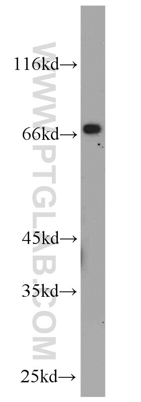 WB analysis of L02 using 11836-1-AP