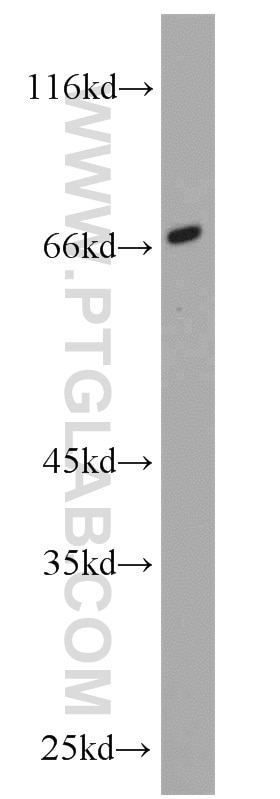 Western Blot (WB) analysis of Jurkat cells using LBP Polyclonal antibody (11836-1-AP)