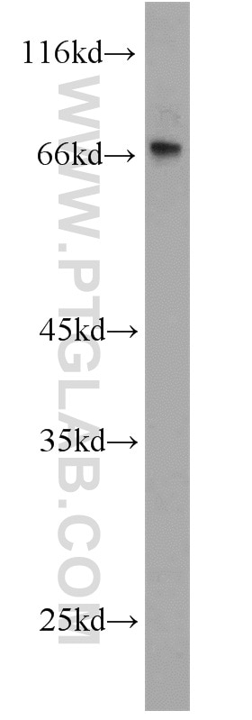 Western Blot (WB) analysis of A431 cells using LBP Polyclonal antibody (11836-1-AP)