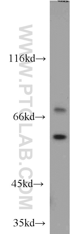 Western Blot (WB) analysis of HeLa cells using LBP Polyclonal antibody (11836-1-AP)