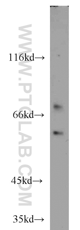 Western Blot (WB) analysis of A549 cells using LBP Polyclonal antibody (11836-1-AP)