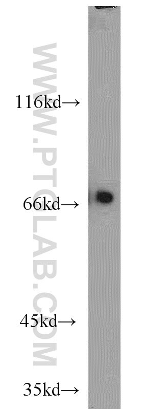 Western Blot (WB) analysis of A549 cells using LBP Polyclonal antibody (11836-1-AP)