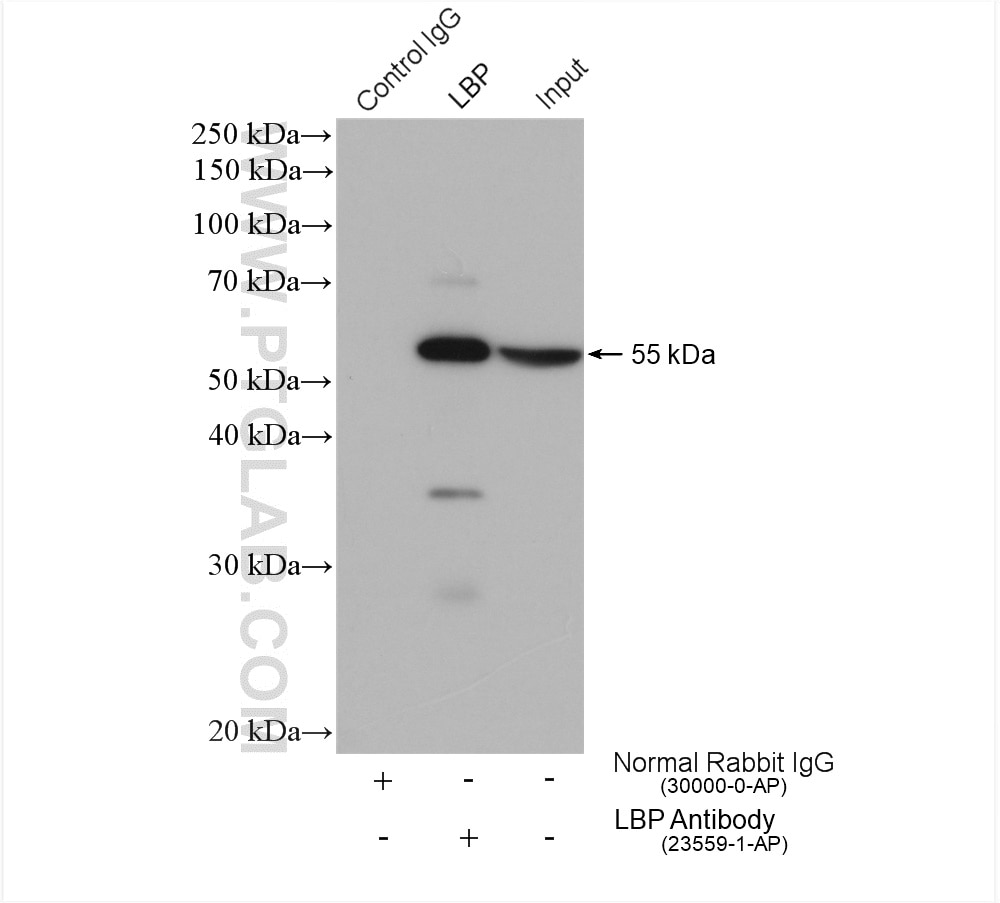Immunoprecipitation (IP) experiment of mouse liver tissue using LBP Polyclonal antibody (23559-1-AP)