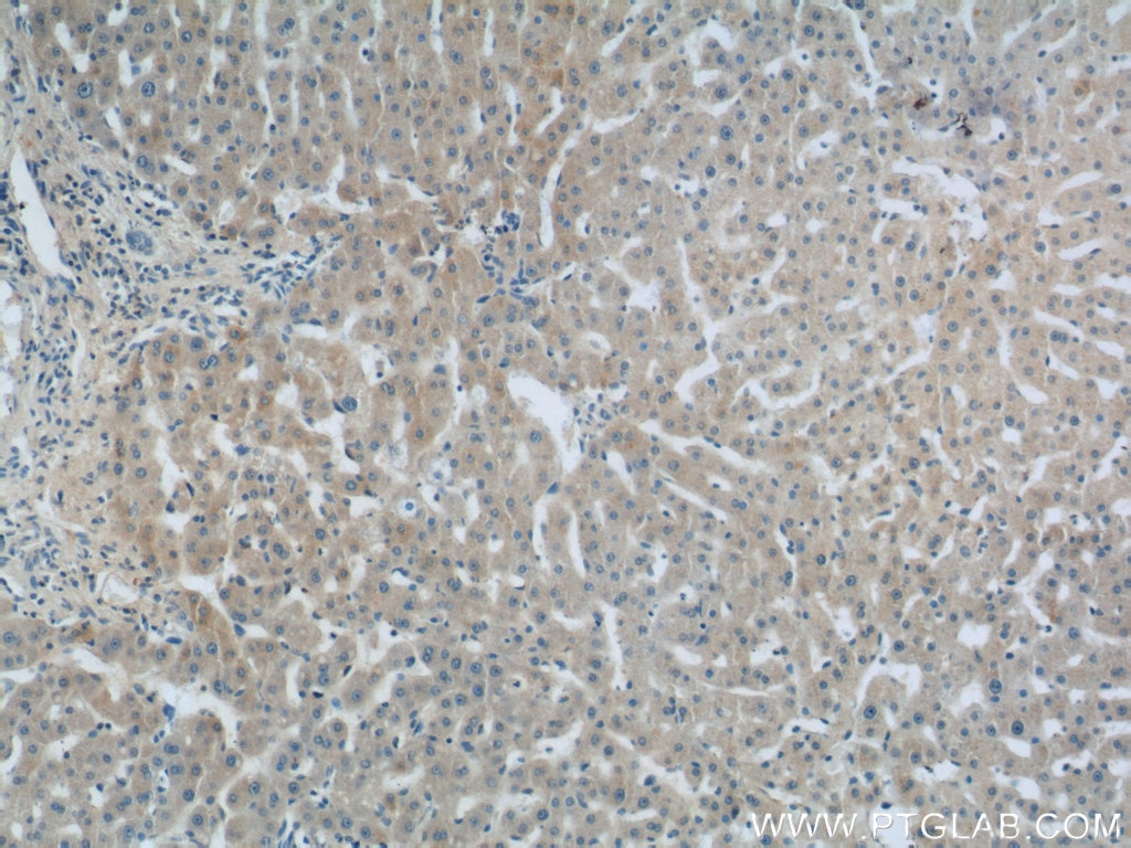 IHC staining of human liver using 66181-1-Ig
