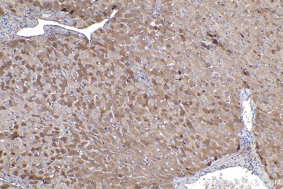 Immunohistochemistry (IHC) staining of human liver tissue using LBP Monoclonal antibody (66181-1-Ig)