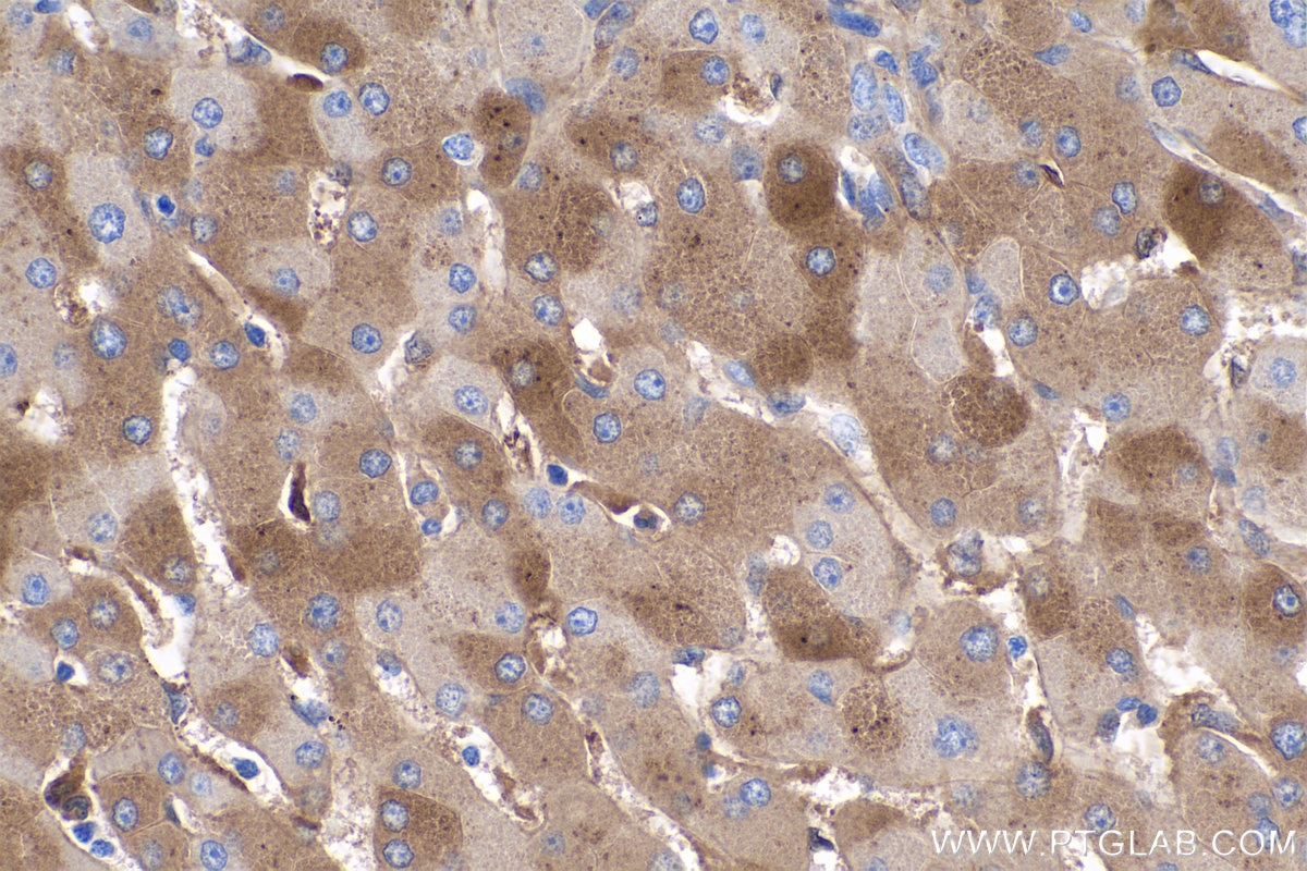 Immunohistochemistry (IHC) staining of human liver tissue using LBP Monoclonal antibody (66181-1-Ig)