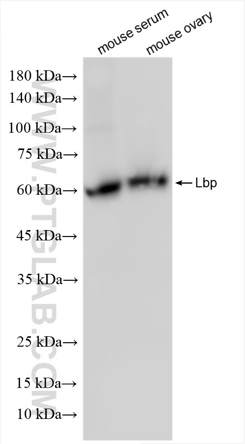 Western Blot (WB) analysis of various lysates using LBP Recombinant antibody (86253-1-RR)