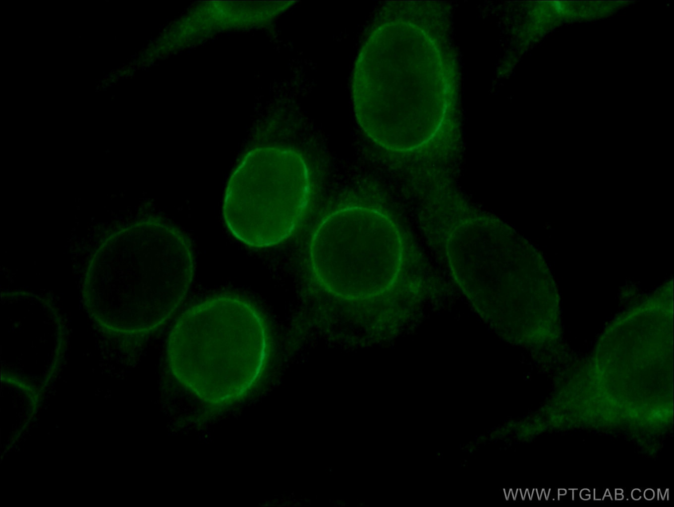Immunofluorescence (IF) / fluorescent staining of C6 cells using LBR Polyclonal antibody (12398-1-AP)